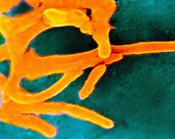 Image: The oral bacteria Fusobacterium nucleatum (Photo courtesy of HealthyDent).